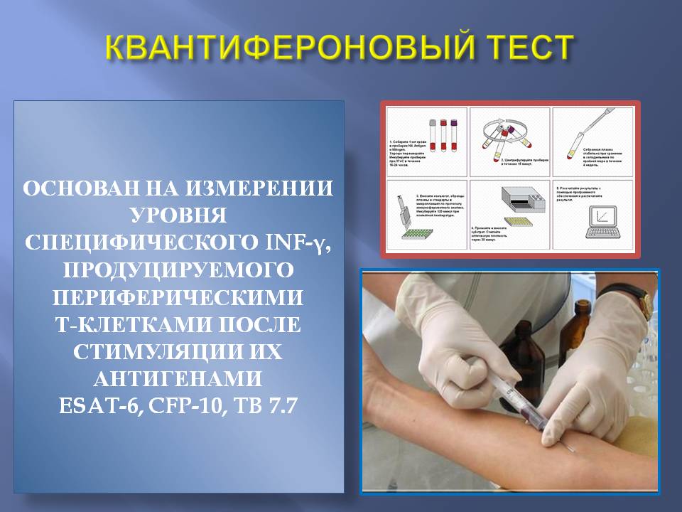 Купить справку квантифероновый тест в СПб с доставкой